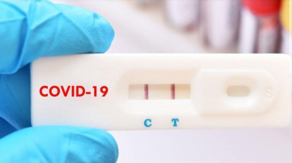 Bộ Y tế yêu cầu công khai niêm yết giá kit test COVID-19