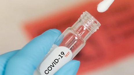 Nhận hàng từ shipper, lưu ý gì để giảm nguy cơ lây nhiễm Covid-19?