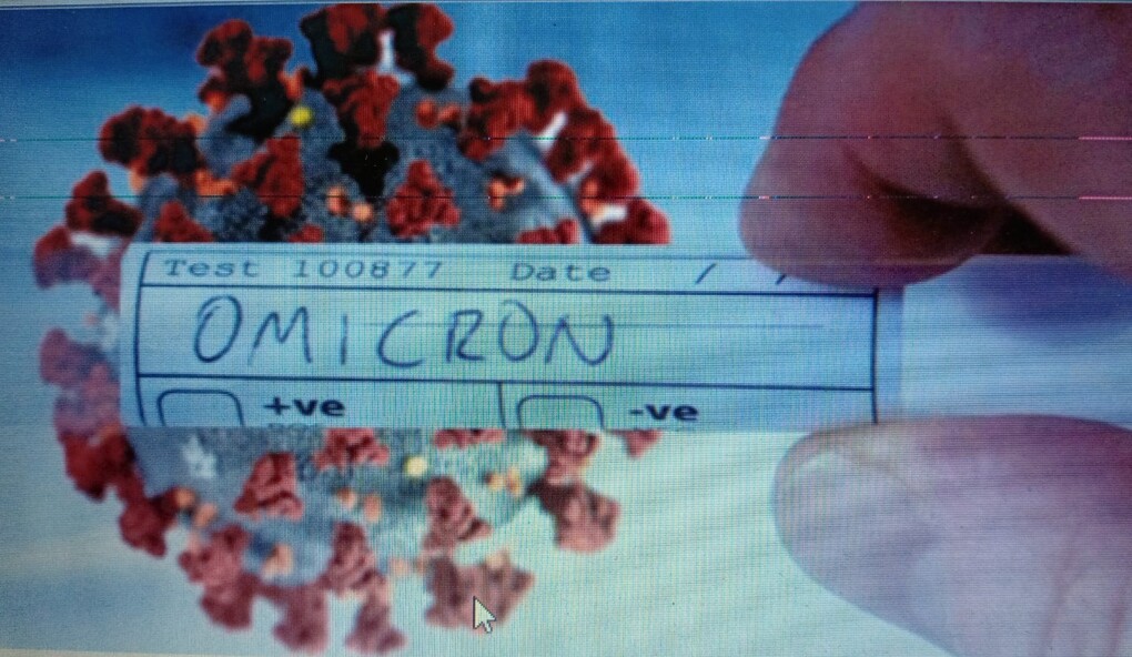 Phân biệt người nhiễm Omicron và các chủng khác