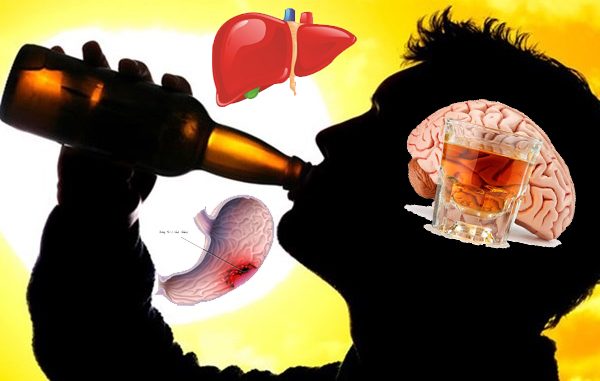 Uống nhiều bia rượu gây bệnh gì?