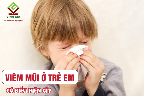 Bệnh viêm mũi ở trẻ em có những biểu hiện gì?